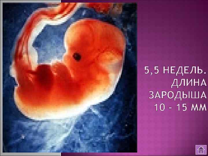 5, 5 НЕДЕЛЬ. ДЛИНА ЗАРОДЫША 10 - 15 ММ. 
