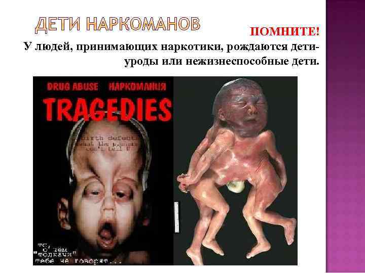 ПОМНИТЕ! У людей, принимающих наркотики, рождаются детиуроды или нежизнеспособные дети. 