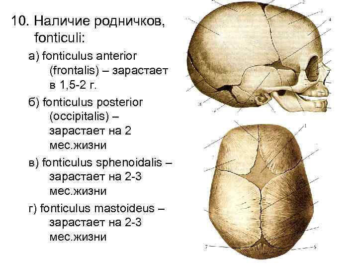 10. Наличие родничков, fonticuli: а) fonticulus anterior (frontalis) – зарастает в 1, 5 -2