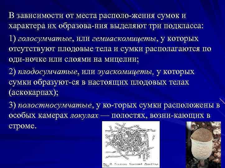 В зависимости от места располо жения сумок и характера их образова ния выделяют три