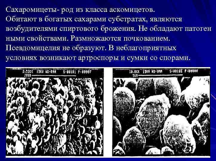 Сахаромицеты род из класса аскомицетов. Обитают в богатых сахарами субстратах, являются возбудителями спиртового брожения.