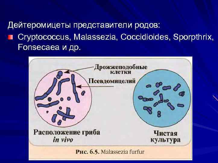Дейтеромицеты представители родов: Cryptococcus, Malassezia, Coccidioides, Sporpthrix, Fonsecaea и др. 