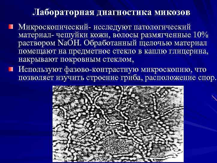 Лабораторная диагностика микозов Микроскопический исследуют патологический материал чешуйки кожи, волосы размягченные 10% раствором Na.