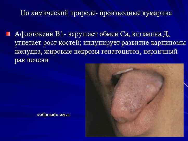 По химической природе производные кумарина Афлотоксин В 1 нарушает обмен Са, витамина Д, угнетает