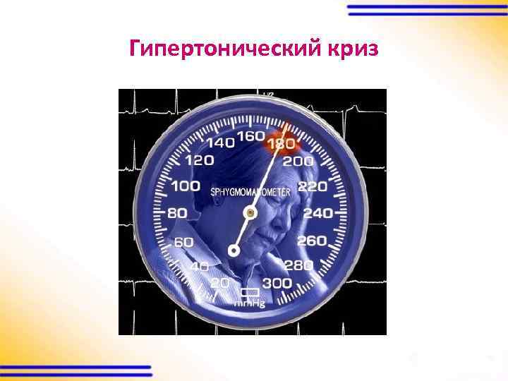 Гипертонический криз 