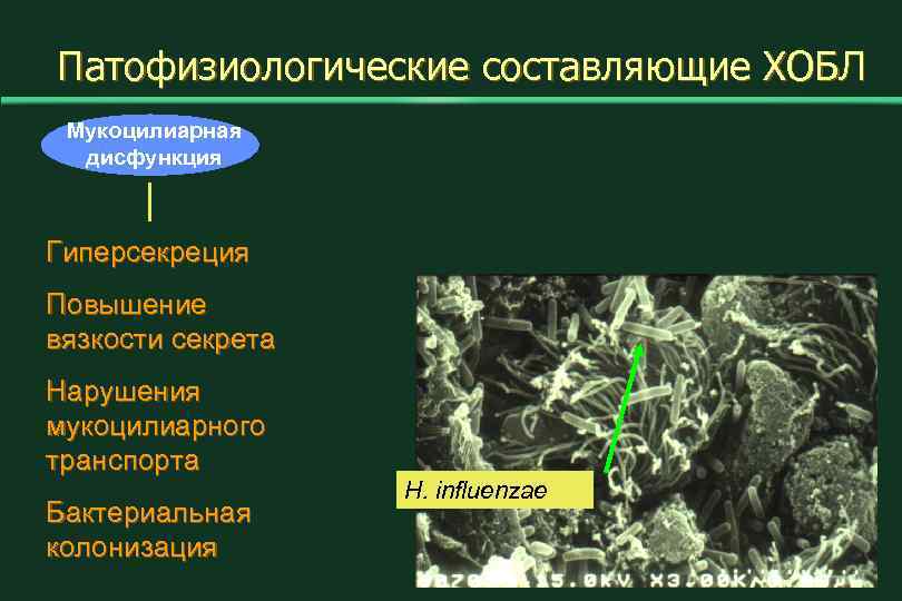 Патофизиологические составляющие ХОБЛ Мукоцилиарная дисфункция Гиперсекреция Повышение вязкости секрета Нарушения мукоцилиарного транспорта Бактериальная колонизация