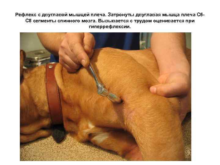 Рефлекс с двуглавой мышцей плеча. Затронуты двуглавая мышца плеча С 6 С 8 сегменты