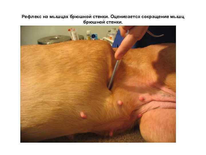 Рефлекс на мышцах брюшной стенки. Оценивается сокращение мышц брюшной стенки. 