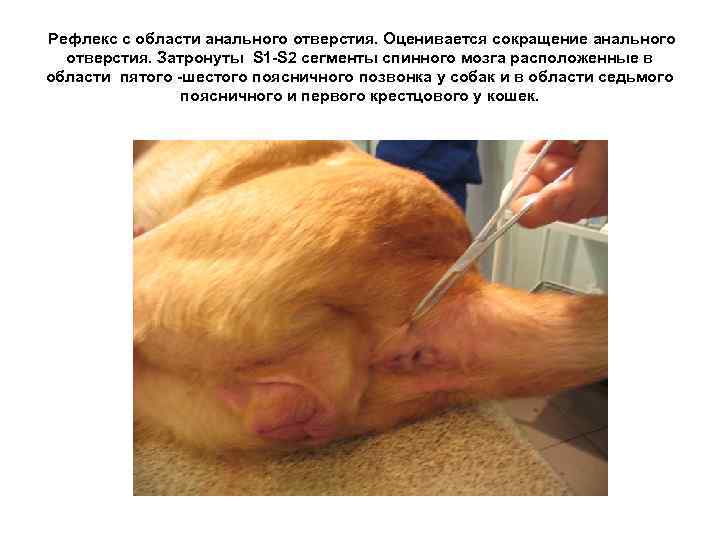 Рефлекс с области анального отверстия. Оценивается сокращение анального отверстия. Затронуты S 1 -S 2