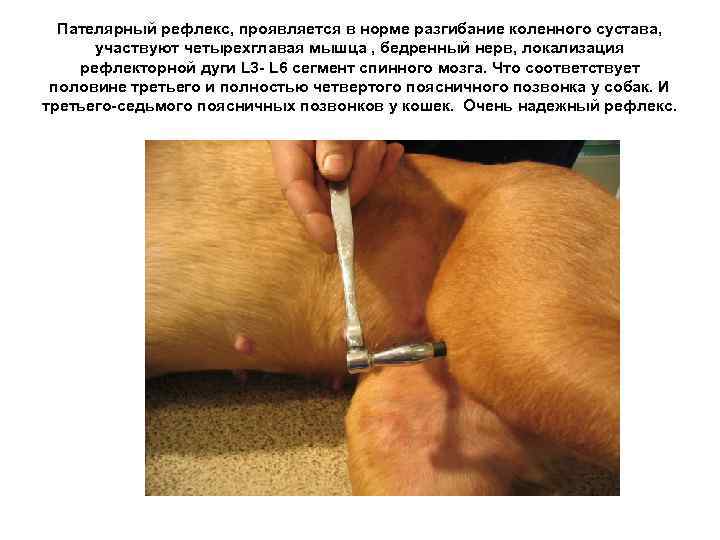 Пателярный рефлекс, проявляется в норме разгибание коленного сустава, участвуют четырехглавая мышца , бедренный нерв,