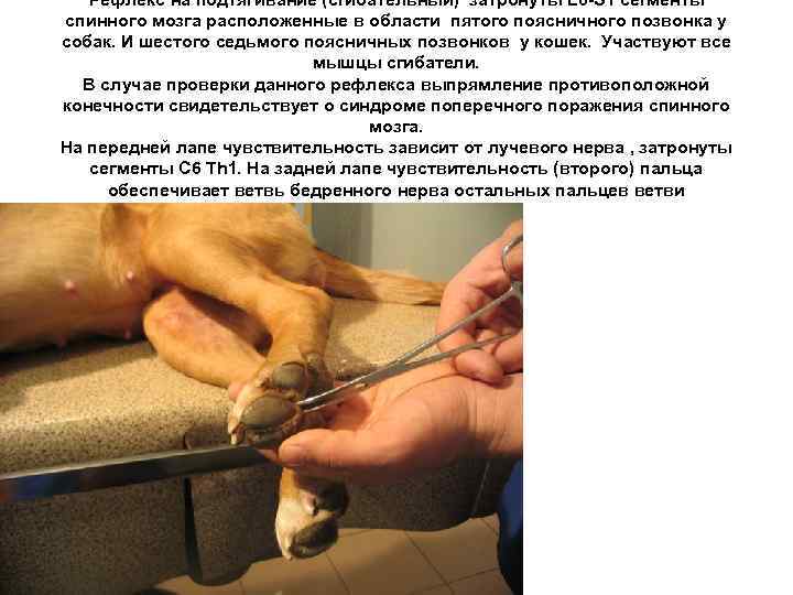 Рефлекс на подтягивание (сгибательный) затронуты L 6 -S 1 сегменты спинного мозга расположенные в