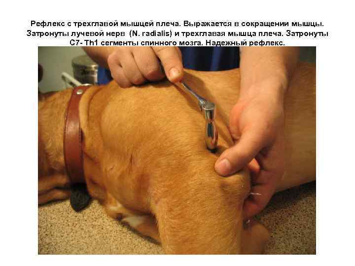 Рефлекс с трехглавой мышцей плеча. Выражается в сокращении мышцы. Затронуты лучевой нерв (N. radialis)