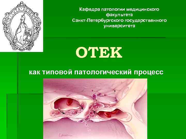 Кафедра патологии медицинского факультета Санкт-Петербургского государственного университета ОТЕК как типовой патологический процесс 