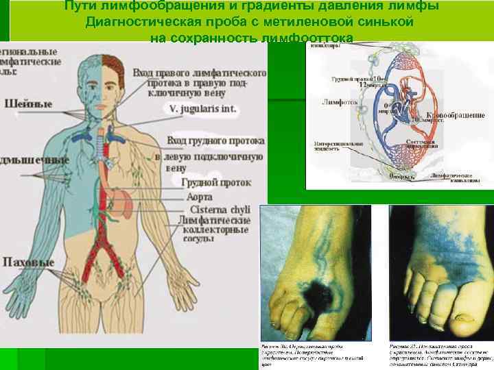 Пути лимфообращения и градиенты давления лимфы Диагностическая проба с метиленовой синькой на сохранность лимфооттока