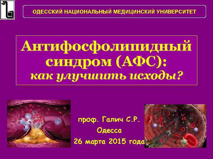 ОДЕССКИЙ НАЦИОНАЛЬНЫЙ МЕДИЦИНСКИЙ УНИВЕРСИТЕТ Антифосфолипидный синдром (АФС): как улучшить исходы? проф. Галич С. Р.