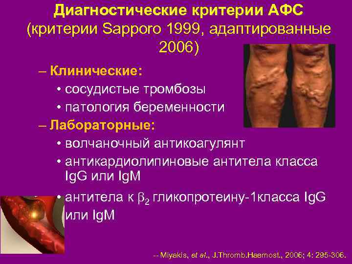 Диагностические критерии АФС (критерии Sapporo 1999, адаптированные 2006) – Клинические: • сосудистые тромбозы •
