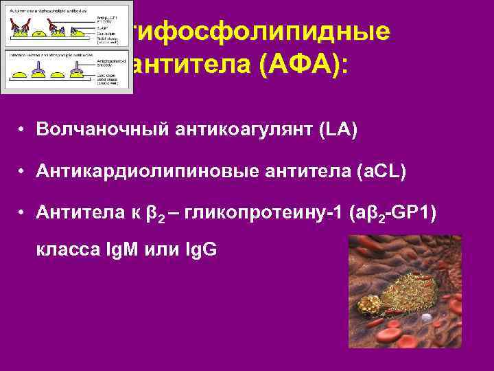 Антифосфолипидные антитела (АФА): • Волчаночный антикоагулянт (LA) • Антикардиолипиновые антитела (a. CL) • Антитела
