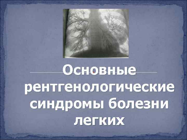 Основные рентгенологические синдромы болезни легких 