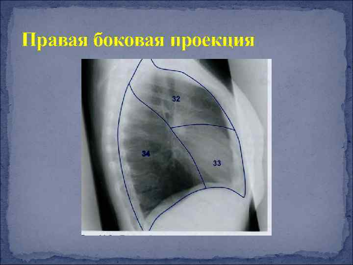 Прямая боковая проекция рентген