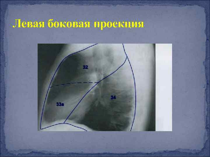 Боковая проекция