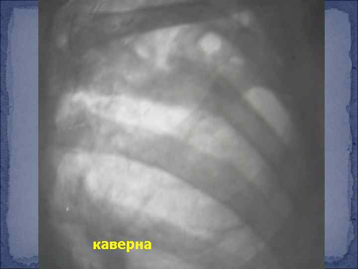 каверна 