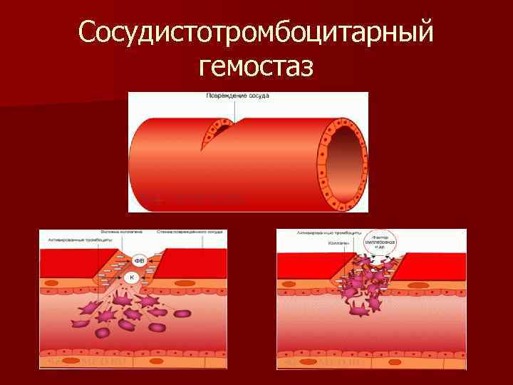 Сосудистотромбоцитарный гемостаз 