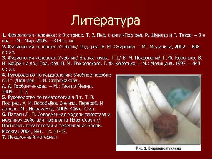 Литература 1. Физиология человека: в 3 -х томах. Т. 2. Пер. с англ. /Под