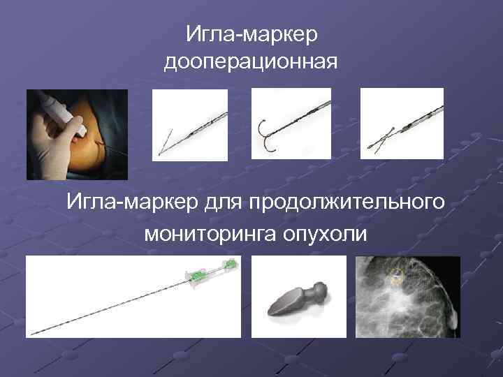 Игла-маркер дооперационная Игла-маркер для продолжительного мониторинга опухоли 