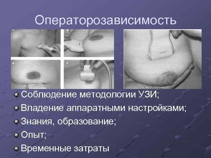 Операторозависимость Соблюдение методологии УЗИ; Владение аппаратными настройками; Знания, образование; Опыт; Временные затраты 