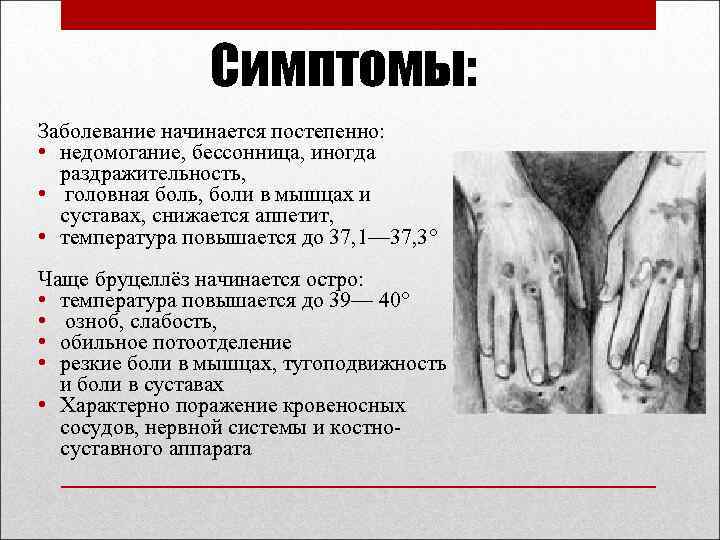 Симптомы: Заболевание начинается постепенно: • недомогание, бессонница, иногда раздражительность, • головная боль, боли в