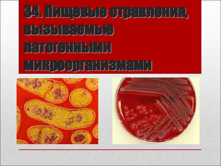 34. Пищевые отравления, вызываемые патогенными микроорганизмами 