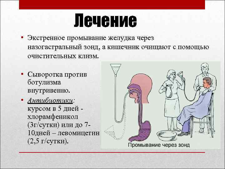 Пациенту без сознания промывание желудка