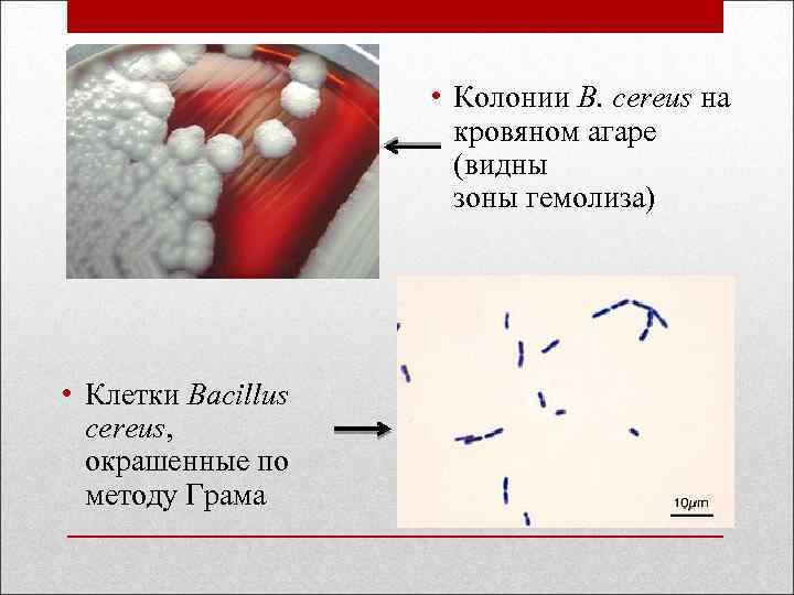  • Колонии B. cereus на кровяном агаре (видны зоны гемолиза) • Клетки Bacillus