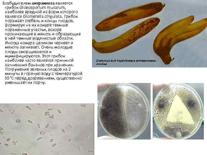  Возбудителем антракноза является грибок Gloeosporium musarum, наиболее вредной из форм которого является Glomerella