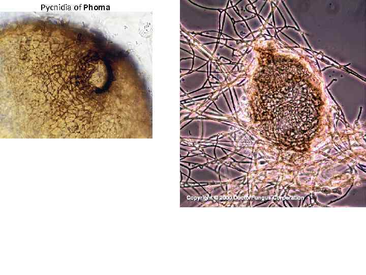 Pycnidia of Phoma 