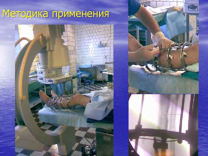 Методика применения 