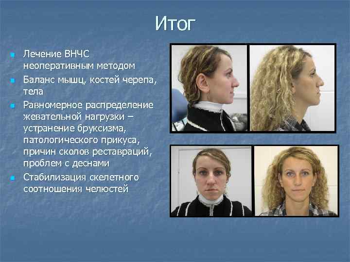 Итог n n Лечение ВНЧС неоперативным методом Баланс мышц, костей черепа, тела Равномерное распределение