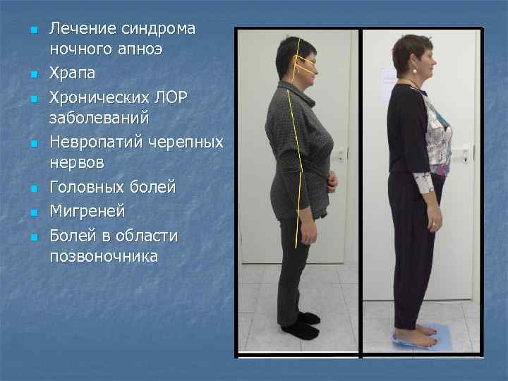 n n n n Лечение синдрома ночного апноэ Храпа Хронических ЛОР заболеваний Невропатий черепных