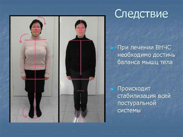 Следствие n n При лечении ВНЧС необходимо достичь баланса мышц тела Происходит стабилизация всей