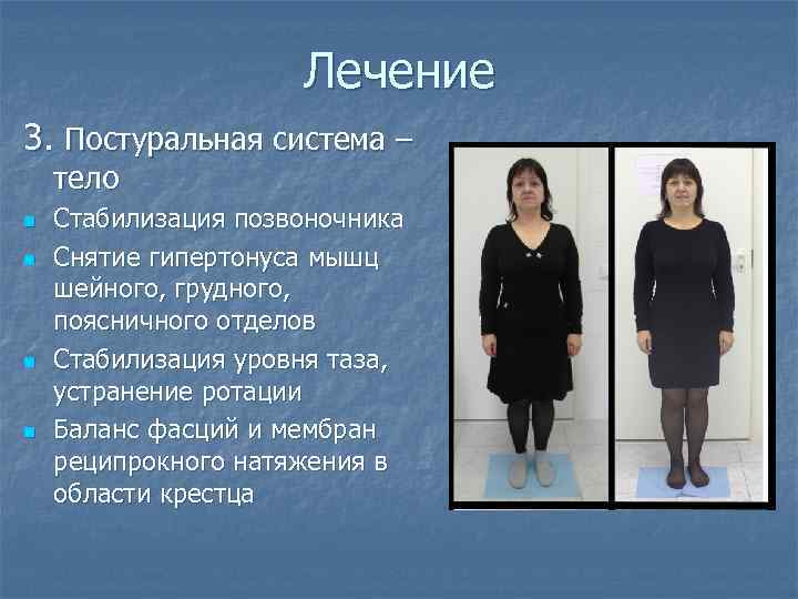 Лечение 3. Постуральная система – тело n n Стабилизация позвоночника Снятие гипертонуса мышц шейного,