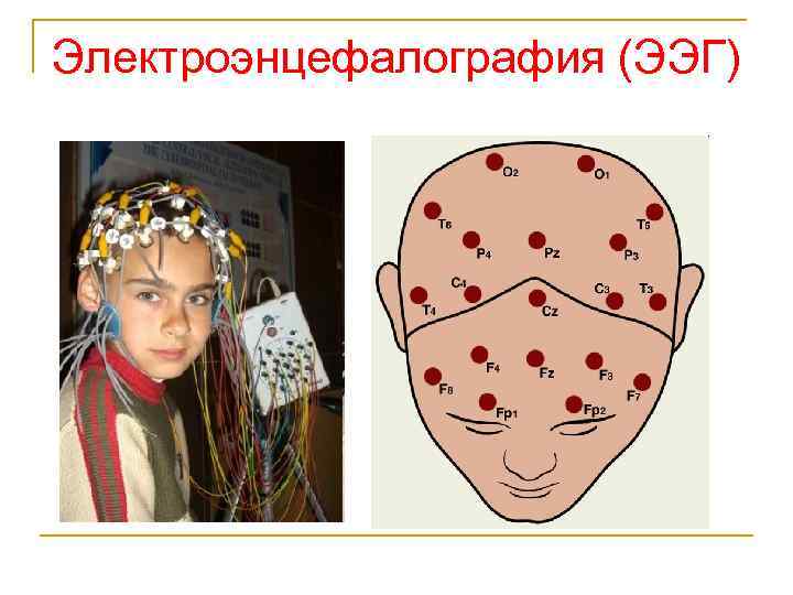 Электроэнцефалография (ЭЭГ) 