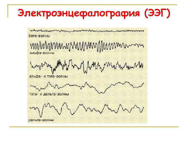 Электроэнцефалография (ЭЭГ) 