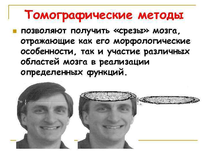 Томографические методы n позволяют получить «срезы» мозга, отражающие как его морфологические особенности, так и