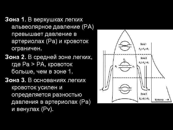 Зона 1. В верхушках легких альвеолярное давление (РА) превышает давление в артериолах (Pa) и