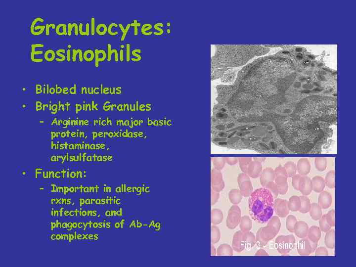 Granulocytes: Eosinophils • Bilobed nucleus • Bright pink Granules – Arginine rich major basic