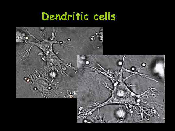 Dendritic cells 