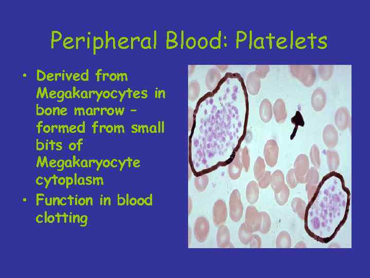 Peripheral Blood: Platelets • Derived from Megakaryocytes in bone marrow – formed from small