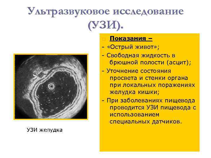 Ультразвуковое исследование (УЗИ). Показания – - «Острый живот» ; - - Свободная жидкость в