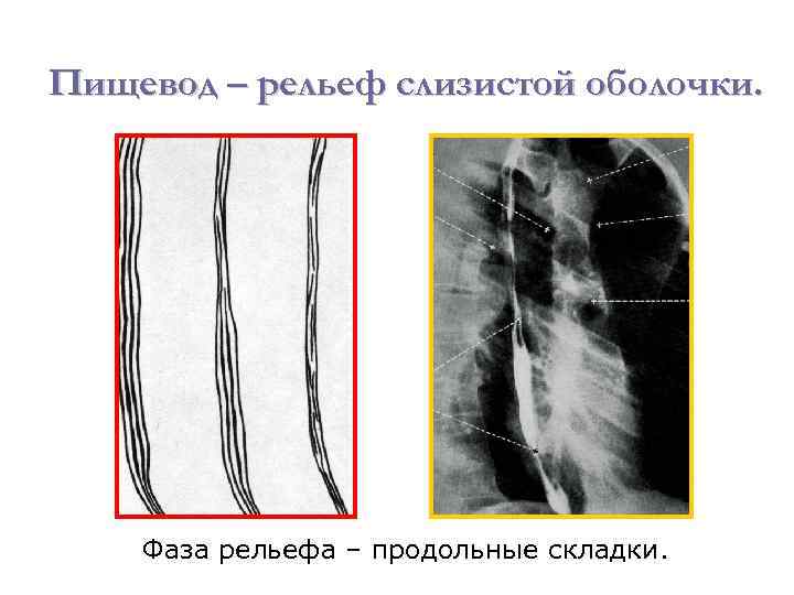 Пищевод – рельеф слизистой оболочки. Фаза рельефа – продольные складки. 