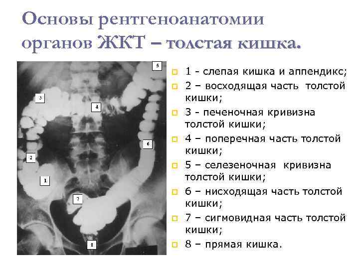 Основы рентгеноанатомии органов ЖКТ – толстая кишка. 1 - слепая кишка и аппендикс; 2